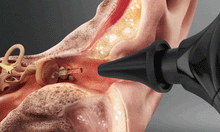 Load image into Gallery viewer, Dotmalls EarClean Pro